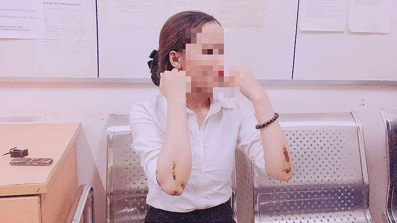 Vì sao tìm được tên cướp kéo lê cô gái hàng chục mét ở Q1?-2