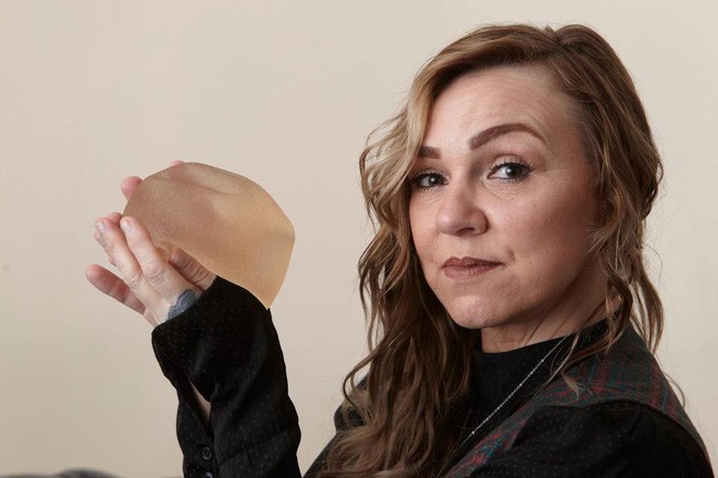 Xấu hổ vì bộ ngực nâng ngoại cỡ, bà mẹ 3 con đã có tự mình giải quyết vì không có tiền đi thẩm mỹ viện-4