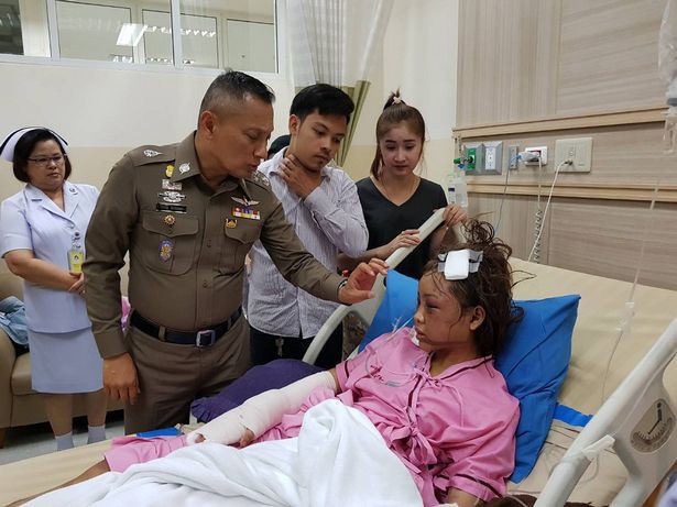 Cô gái bị bạn trai cuồng ghen livetream cảnh đánh đập, đốt tóc đến biến dạng mặt-4