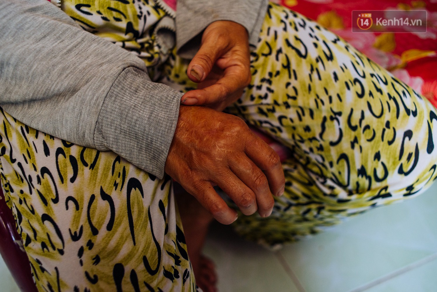 Người mẹ hiến tạng con trai chết não để hồi sinh 5 cuộc đời khác và mở ra tương lai mới cho người con nhỏ-3