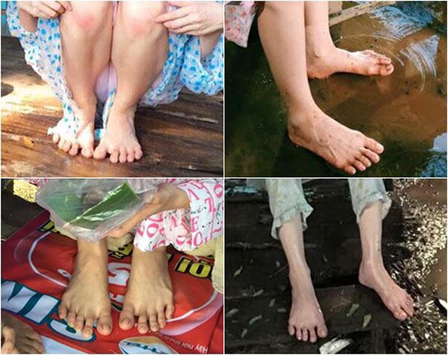 3 mỹ nhân tưởng như hoàn hảo nhất showbiz lại vất vả tìm đồ che khuyết điểm-1