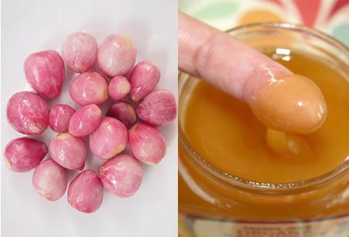 Sẹo thâm lâu năm cứng đầu đến mấy cũng phải đầu hàng với những mẹo dưới đây-3