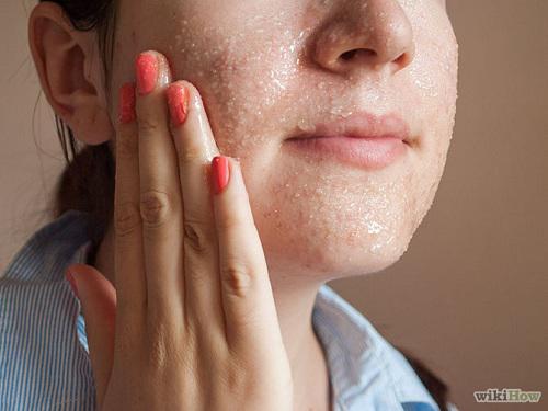 Sẹo thâm lâu năm cứng đầu đến mấy cũng phải đầu hàng với những mẹo dưới đây-2