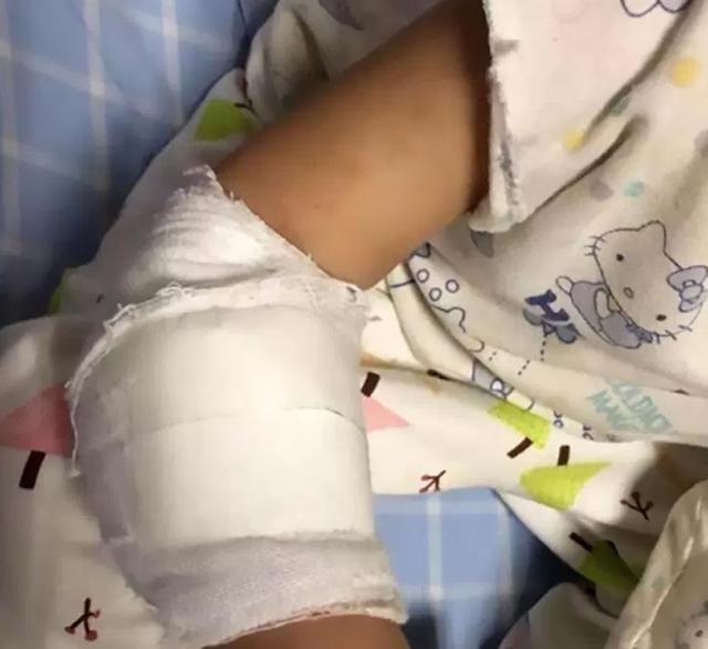 Bé gái 4 tuổi suýt mất một bên tay chỉ vì vật dụng nhỏ xíu nhà nào cũng có-5