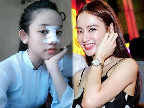 Cô gái 22 tuổi xinh đẹp đã tử vong sau 2 tháng hôn mê do phẫu thuật nâng mũi tại Hà Nội-4