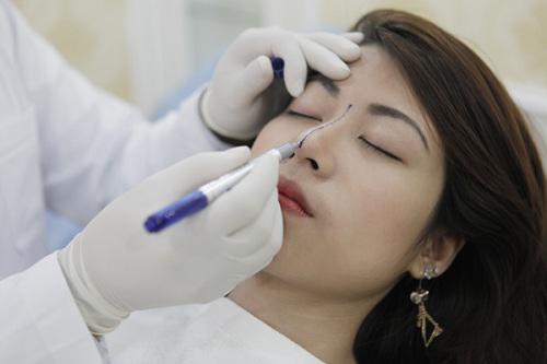 Phẫu thuật nâng mũi có ảnh hưởng gì không, đọc bài viết dưới đây bạn sẽ rõ!-3