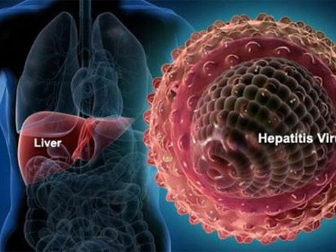 Ung thư gan: 17 nghìn người chết mỗi năm và 6 nguyên nhân cần nhớ