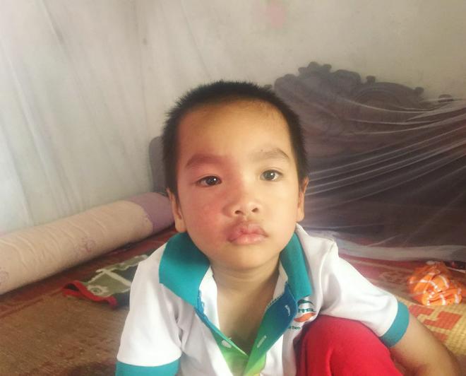 Chồng mất vì tai nạn, người vợ trẻ gồng gánh” chăm con song sinh 1 bại não, 1 mù lòa-3