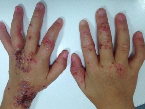 Qua đêm” với gái lạ, chàng trai lở loét người vì không làm việc quan trọng trước khi yêu-3