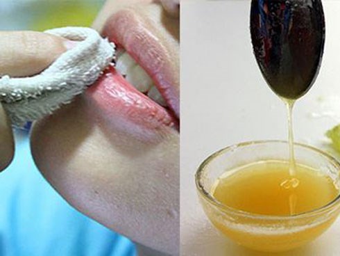 Với 5 ngàn đồng, chị em có ngay cách dưỡng môi bằng mật ong khỏi cần bôi son