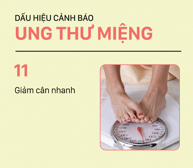 Đừng nhầm lẫn với bệnh ở miệng, đây là những dấu hiệu cảnh báo ung thư mà bạn nên nhớ-11