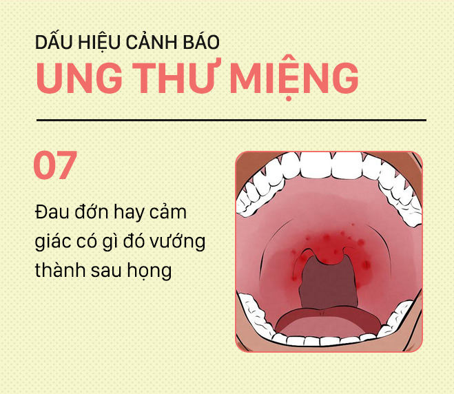 Đừng nhầm lẫn với bệnh ở miệng, đây là những dấu hiệu cảnh báo ung thư mà bạn nên nhớ-7