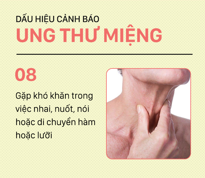 Đừng nhầm lẫn với bệnh ở miệng, đây là những dấu hiệu cảnh báo ung thư mà bạn nên nhớ-8