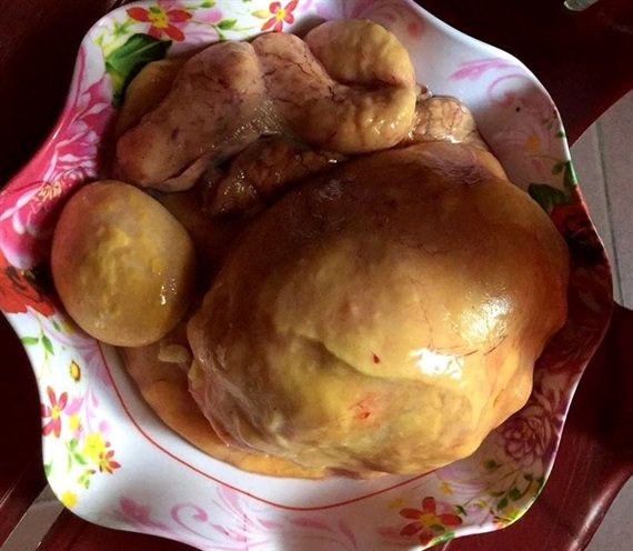 Làm thịt gà, phát hiện dị vật nghi là kê bảo-2