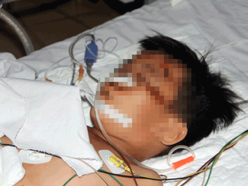 Không có tiền nộp viện phí, người cha tức tưởi tự tay giết chết con trai 7 tuổi