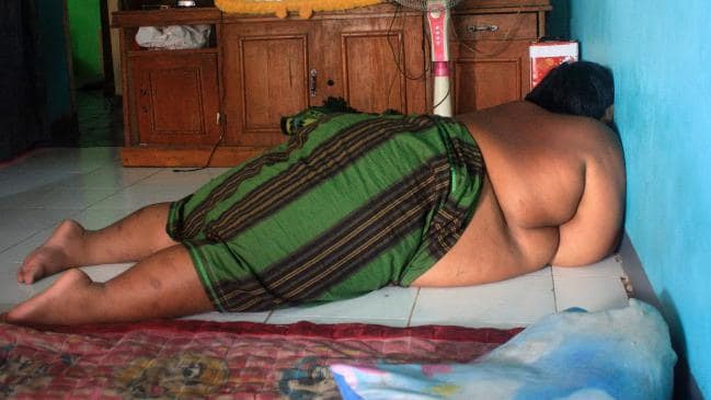Cậu bé béo nhất thế giới giảm 83 kg, có thể đến trường đi học-2