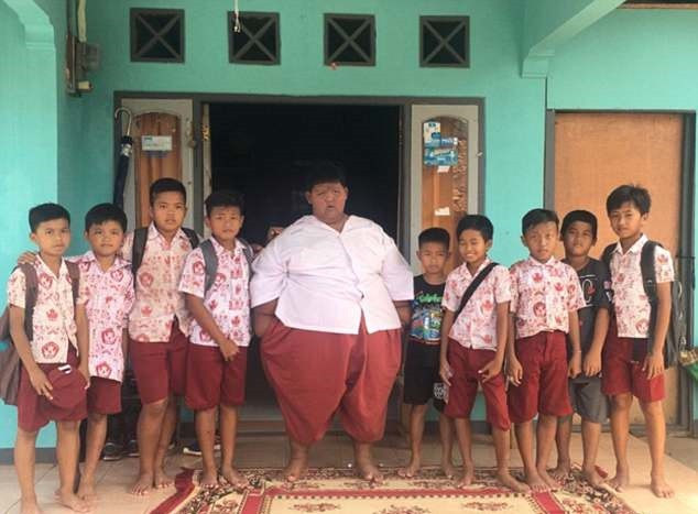 Cậu bé béo nhất thế giới giảm 83 kg, có thể đến trường đi học-6