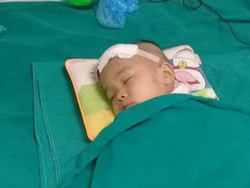 Bé gái hơn 3 tuổi đau đớn trải qua 2 lần phẫu thuật trị xạ u não