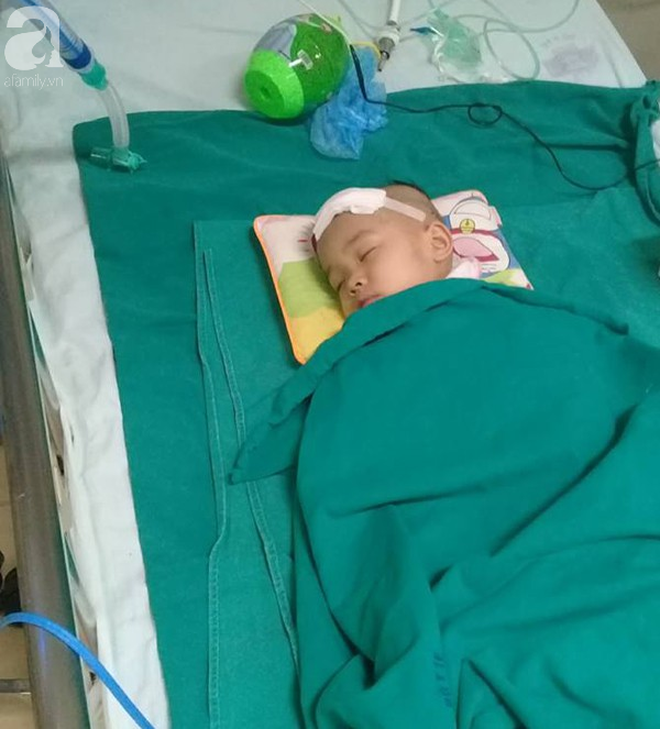 Bé gái hơn 3 tuổi đau đớn trải qua 2 lần phẫu thuật trị xạ u não-1