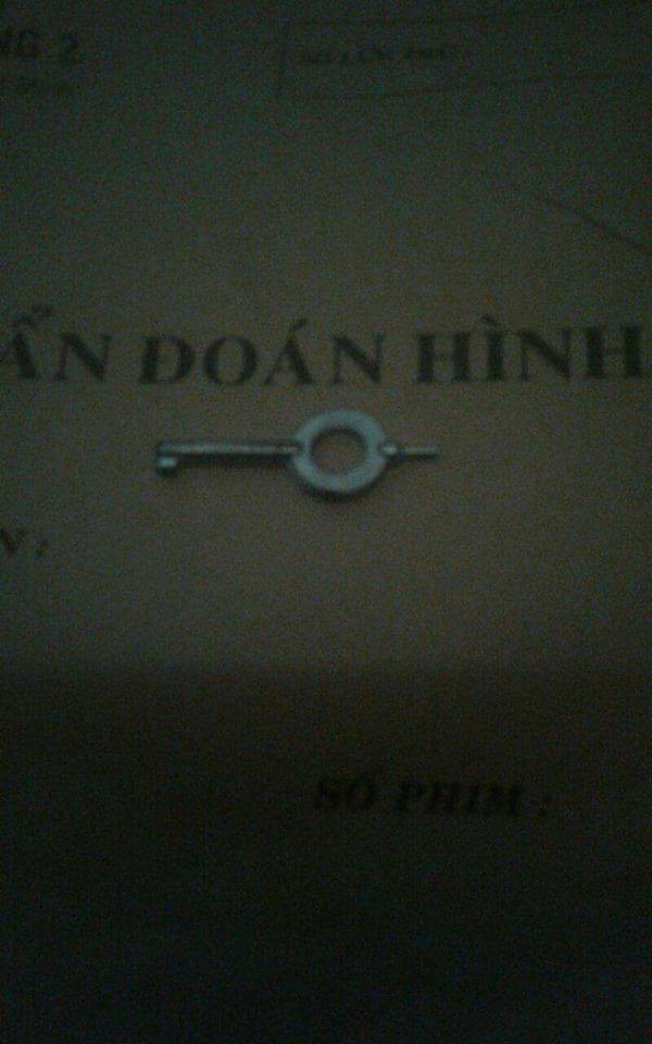 Lấy thành công chiếc chìa khóa trong bụng bé trai 5 tuổi mà không cần phẫu thuật-3