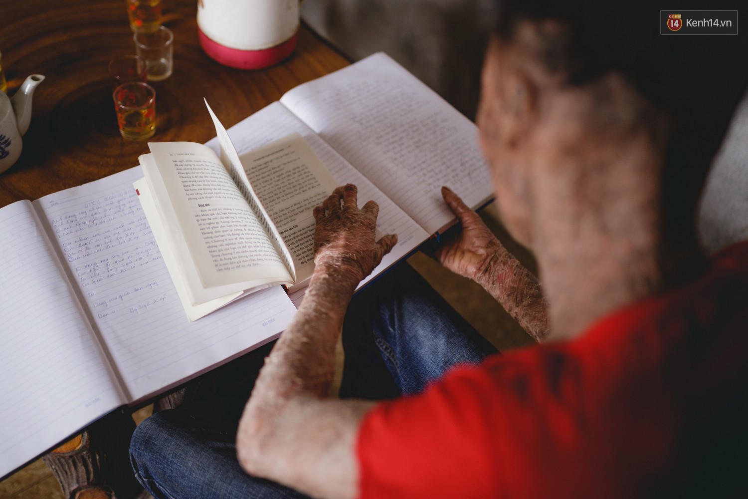 Chàng trai người cá lạc quan ở Hà Nội: Nhìn thấy bộ dạng của mình, nhiều người hỏi sao không chết đi, sống để làm gì?-13