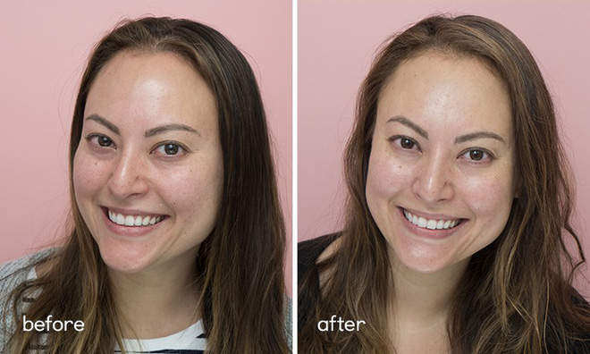 Chỉ sau 5 ngày sử dụng, làn da của 5 cô nàng đã thay đổi hoàn toàn nhờ loại nước thần thánh” này-5