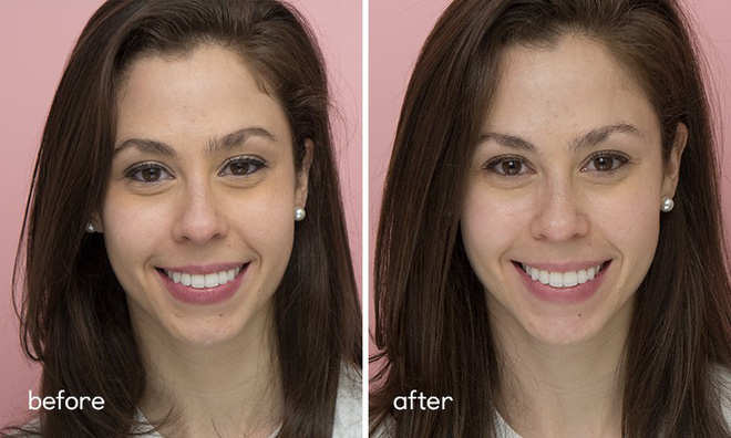 Chỉ sau 5 ngày sử dụng, làn da của 5 cô nàng đã thay đổi hoàn toàn nhờ loại nước thần thánh” này-7