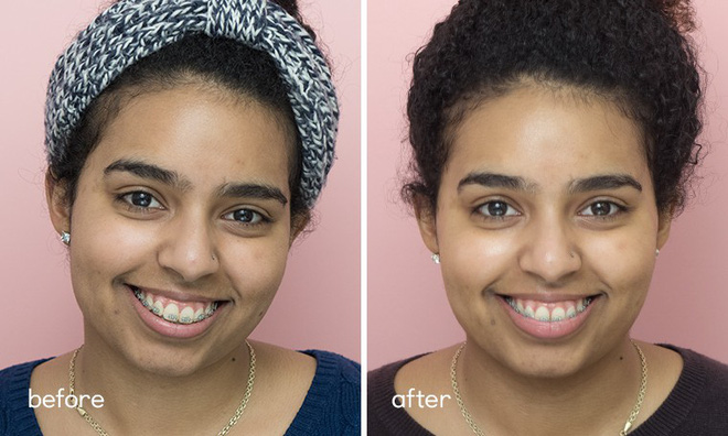 Chỉ sau 5 ngày sử dụng, làn da của 5 cô nàng đã thay đổi hoàn toàn nhờ loại nước thần thánh” này-8