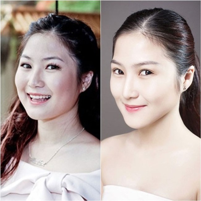Người đẹp Việt giảm cân cấp tốc khiến người hâm mộ lầm tưởng phẫu thuật thẩm mỹ-8