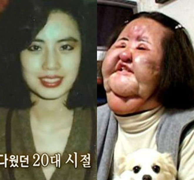 Mỹ nhân dao kéo khi có tuổi: Người vẫn đẹp tới mức khó tin, kẻ trở thành thảm họa-17