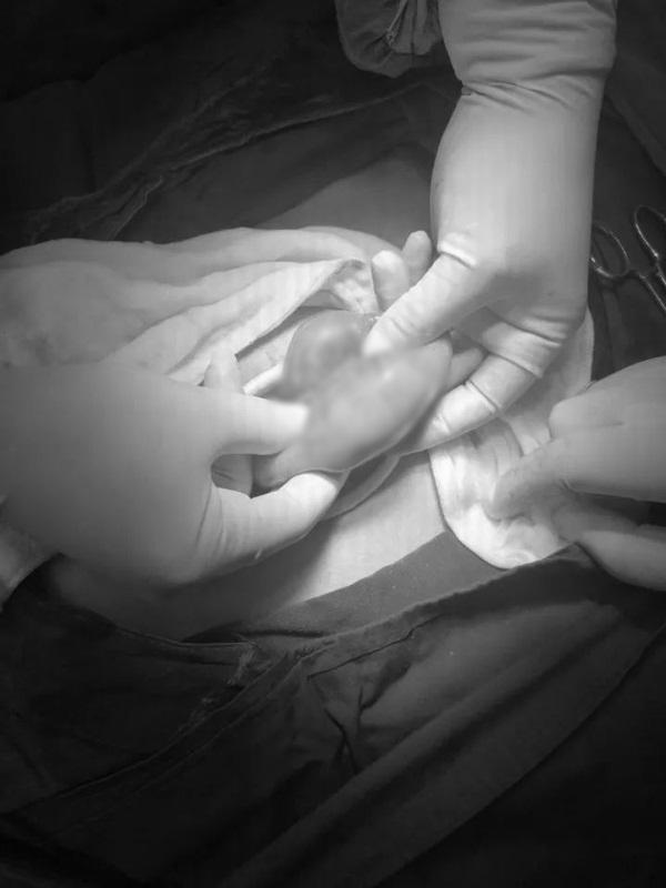 Ăn lựu mỗi ngày, người phụ nữ trẻ khiến bác sĩ giật mình khi thấy thứ nằm trong bụng-1