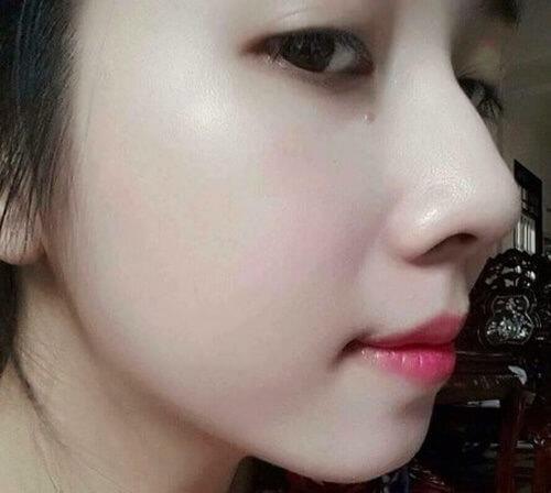 Những cách làm trắng da mặt tự nhiên tại nhà tiết kiệm cả triệu tiền mỹ phẩm-6