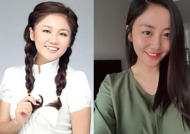 Nghi vấn độn cằm và cuộc lột xác” của loạt sao: người hóa mỹ nhân, kẻ thành thảm họa!-7