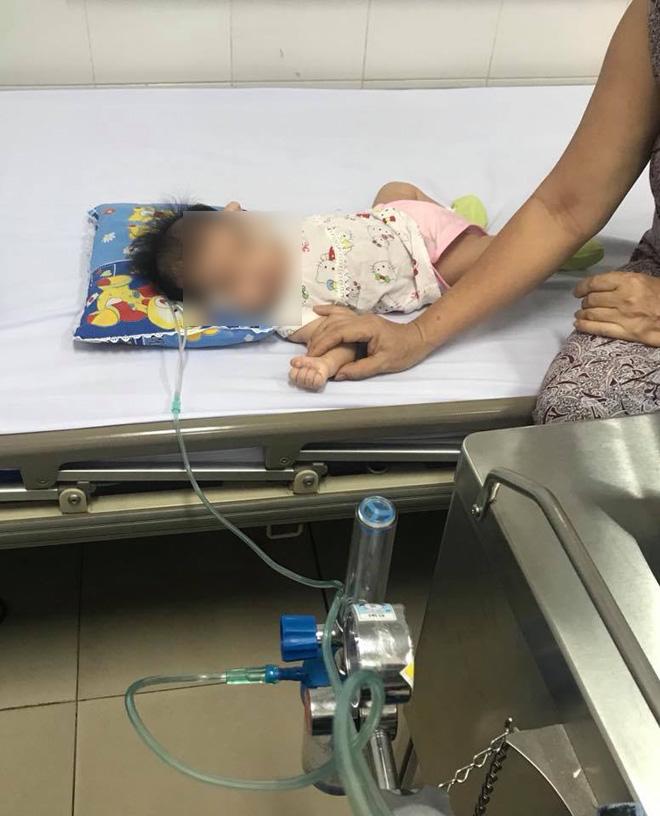 Rơ lưỡi cho con sau khi bú, hành động tai hại của mẹ khiến bé 2 tháng tuổi nhập viện-1