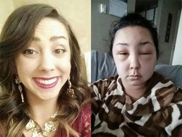 Cô giáo tử vong do nhuộm tóc, chuyên gia cảnh báo 5 người phải tránh xa mốt làm đẹp này-1