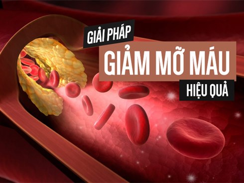 Ai cũng có thể mắc bệnh mỡ máu cao: Đây là 4 giải pháp bạn nên thực hiện cấp tốc