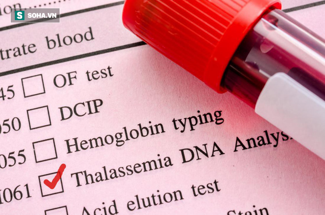 Độ nguy hiểm của bệnh khiến hàng loạt cặp vợ chồng Việt ly dị, điều trị tới 3 tỉ đồng-2