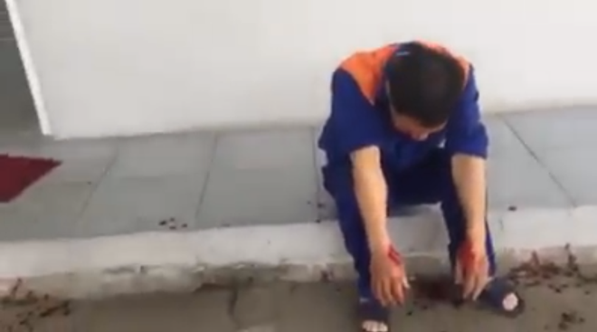 Clip: Nghi bị đổ thiếu, khách hàng đánh nhân viên cây xăng chảy máu mồm-2