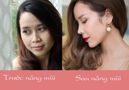 Xuất hiện với diện mạo khác lạ, phải chăng Lưu Hương Giang chạy theo trào lưu độn trán?-1