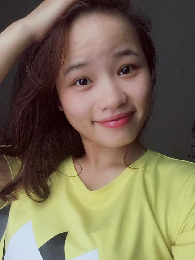 Dùng dầu tẩy trang sai cách, cô gái trẻ đắng lòng vì làn da bị tàn phá nặng nề bởi mụn-3