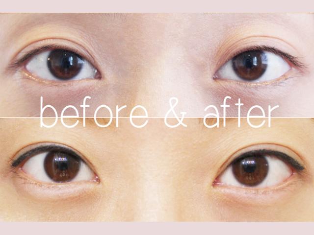 Không phải ai cũng biết nhấn mí mắt có hại không và cần lưu ý gì-9