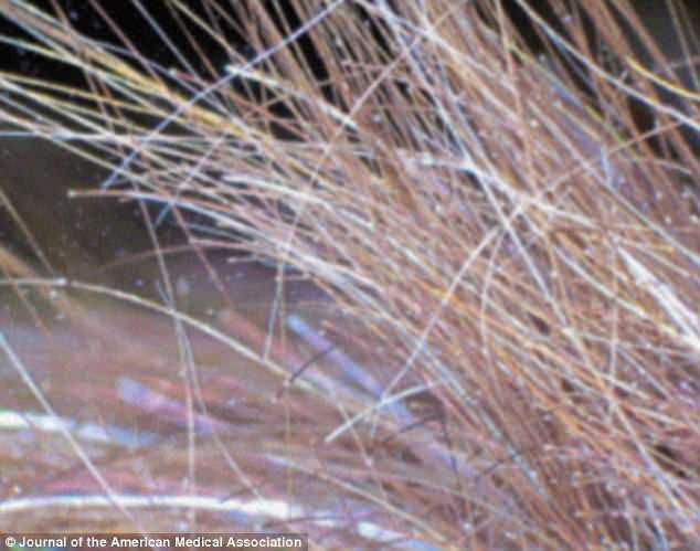 Hi hữu: Ăn bí đỏ ai ngờ rụng sạch sành xanh lông trên người-3