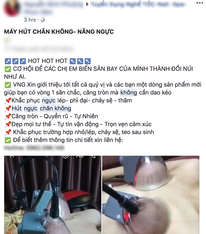 Thực hư phương pháp nâng ngực bằng máy hút, biến sân bay thành đồi núi đang được chị em chia sẻ rầm rộ-3