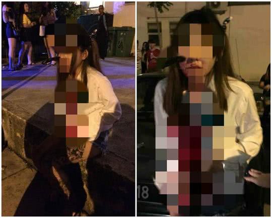 Bị tấn công khi đang bắt taxi, cô gái bình tĩnh đi báo công an với con dao cắm giữa mặt-1