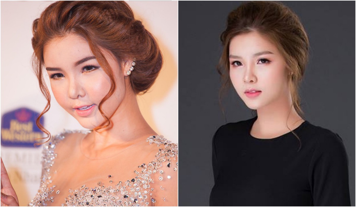 Những bộ phận bị cho là biến dạng sau phẫu thuật thẩm mỹ của sao Việt giờ ra sao?-10