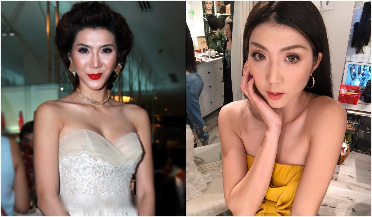 Những bộ phận bị cho là biến dạng sau phẫu thuật thẩm mỹ của sao Việt giờ ra sao?-13