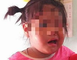 Cô giáo bị tố đánh trẻ liệt dây thần kinh, méo mồm tạm nghỉ việc-1