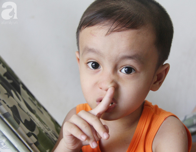 Bị điện giật cháy người không có tiền chạy chữa, bố xót xa nhìn con trai 4 tuổi không nhận ra mình-12