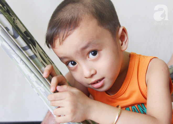 Bị điện giật cháy người không có tiền chạy chữa, bố xót xa nhìn con trai 4 tuổi không nhận ra mình-2