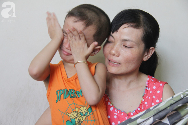 Bị điện giật cháy người không có tiền chạy chữa, bố xót xa nhìn con trai 4 tuổi không nhận ra mình-4